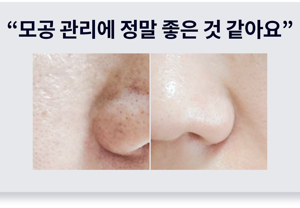 이미지 설명이 없습니다.