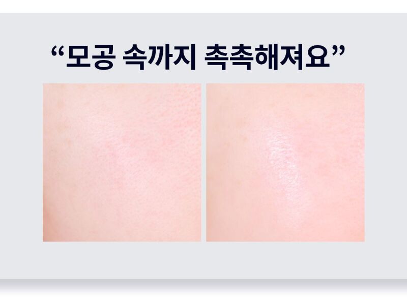 이미지 설명이 없습니다.