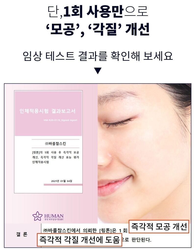 이미지 설명이 없습니다.