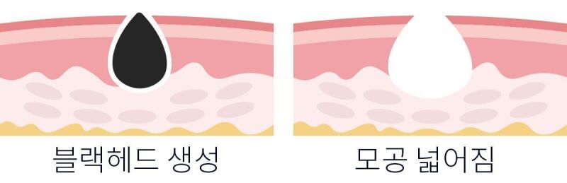 이미지 설명이 없습니다.