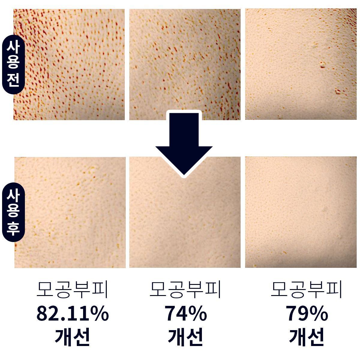 이미지 설명이 없습니다.