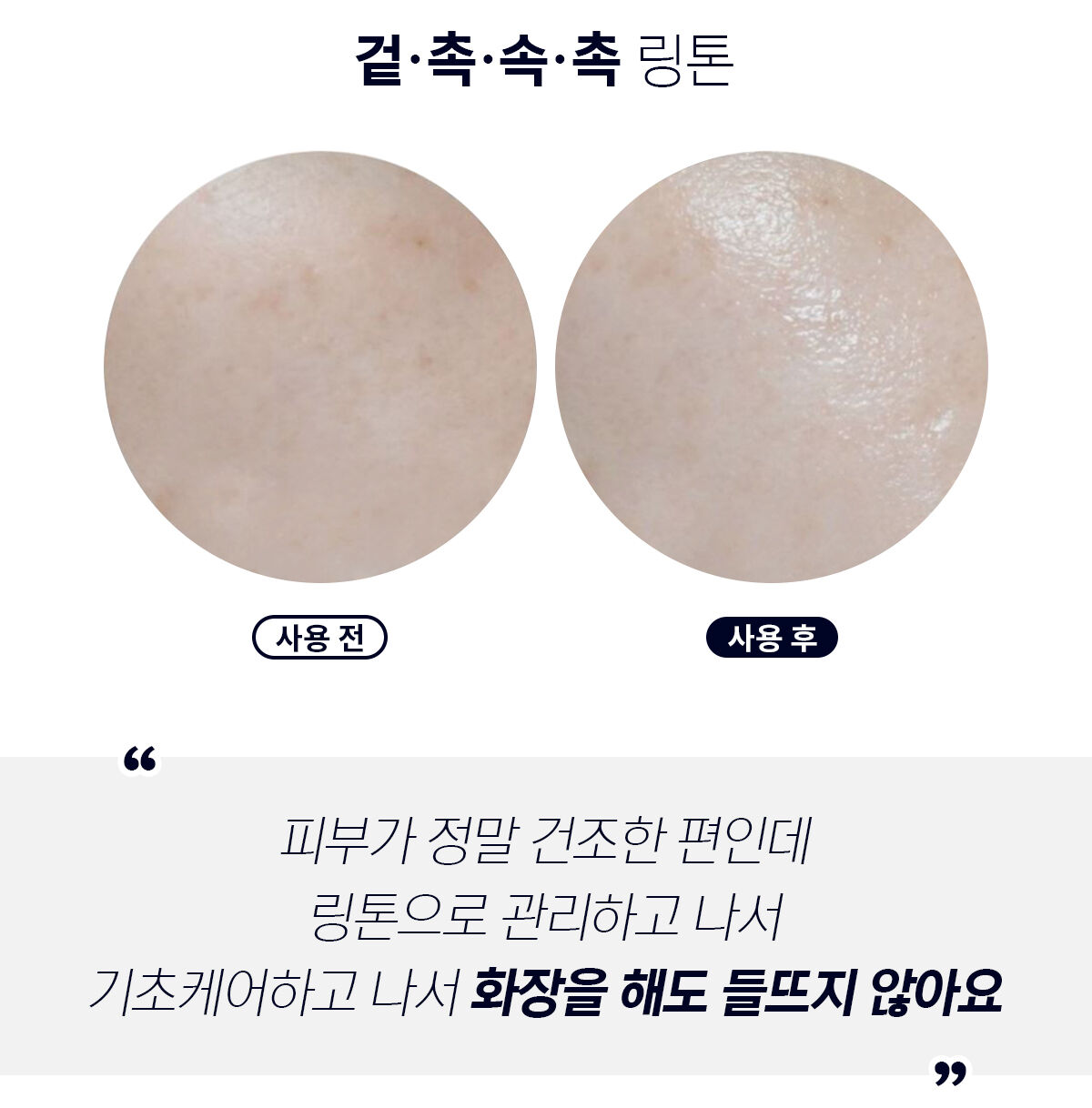 이미지 설명이 없습니다.