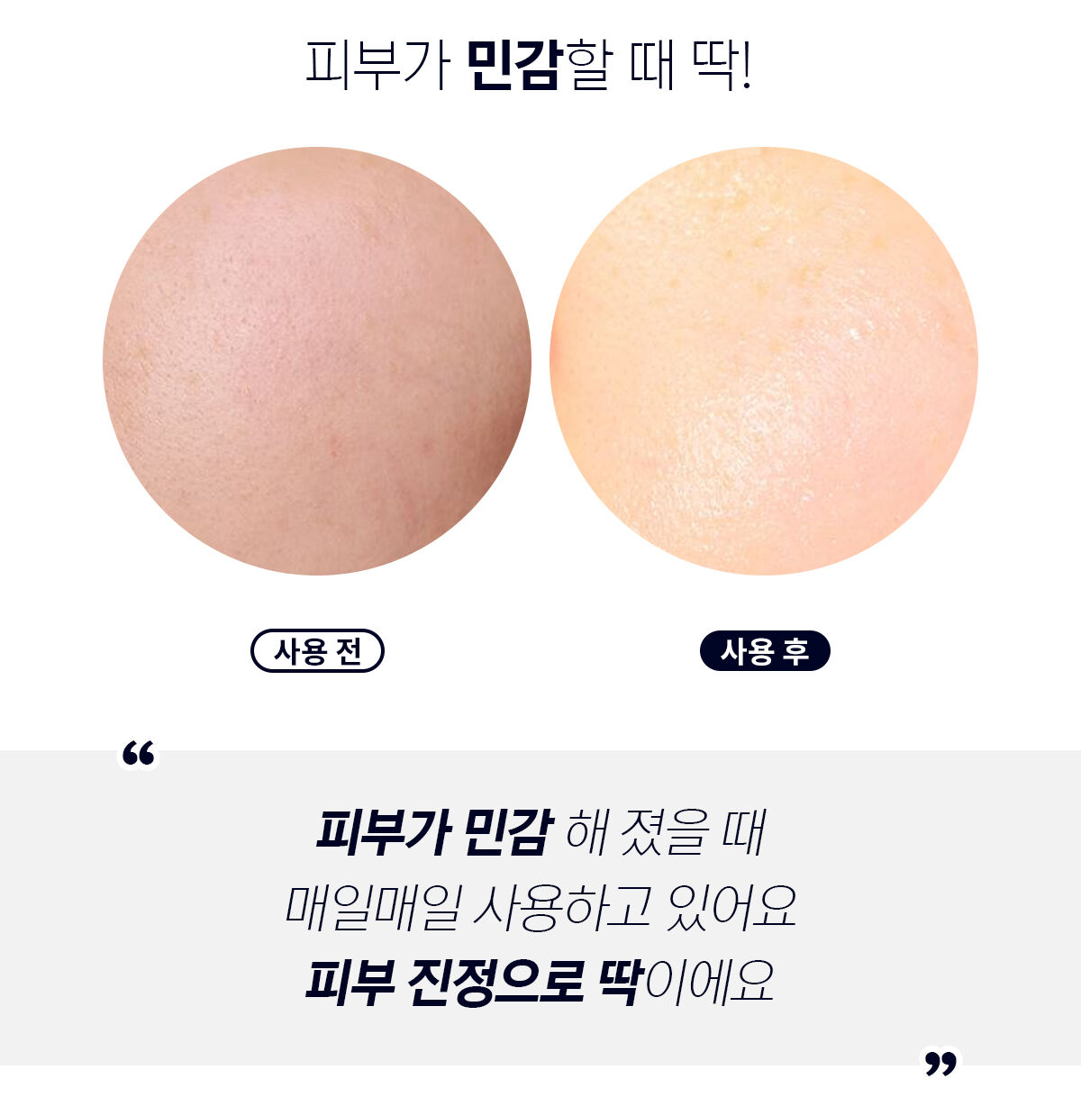 이미지 설명이 없습니다.