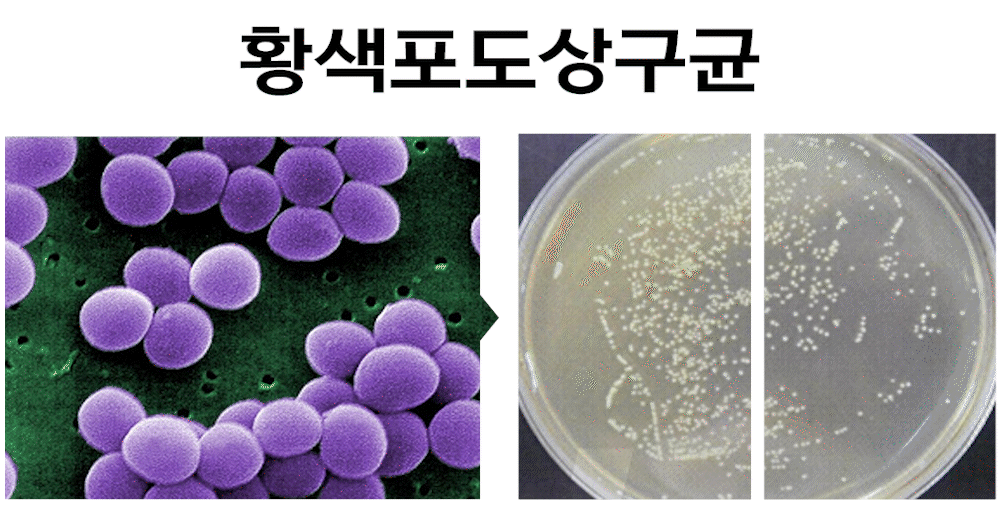 황색포도상구균.gif